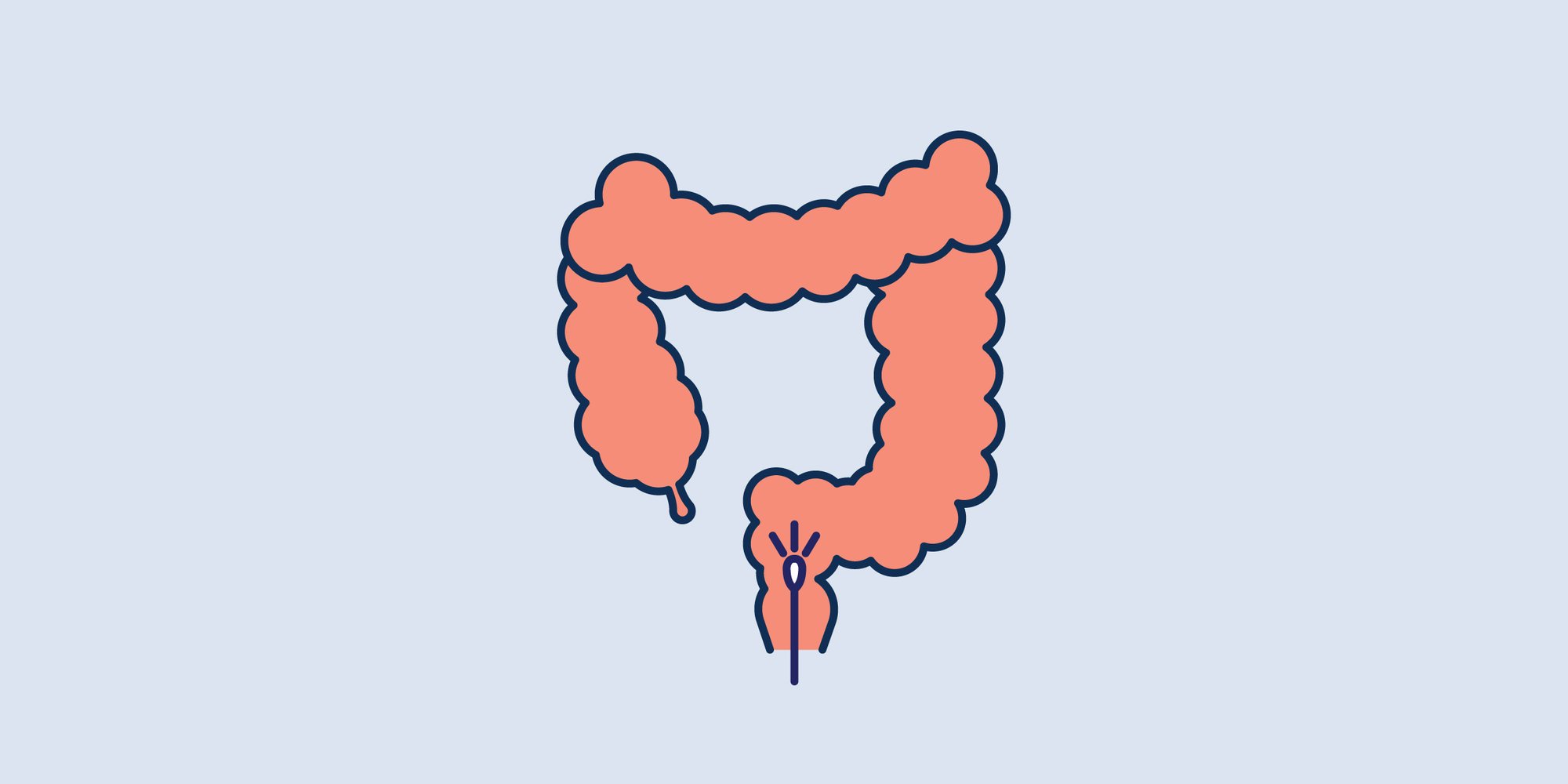 Flexible Sigmoidoscopy Flexible Sigmoidoscopy