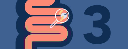 Colorectal cancer is the 3rd most common cancer - not counting skin cancers - found in men and women. Colorectal cancer is the 3rd most common cancer - not counting skin cancers - found in men and women.