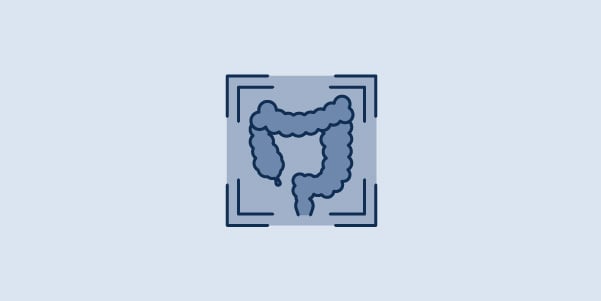 CT Colonoscopy (Virtual Colonoscopy) CT Colonoscopy (Virtual Colonoscopy)