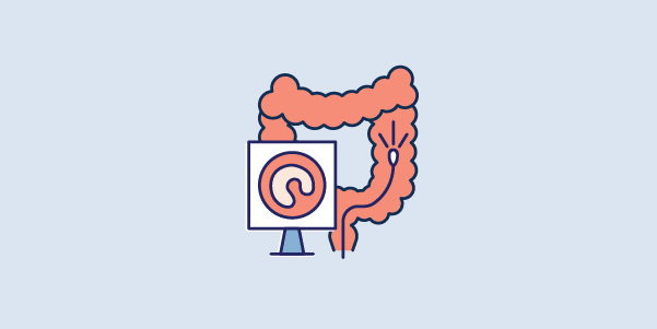Colonoscopy-1 Colonoscopy-1